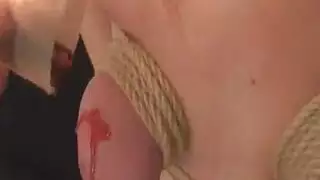 فتح غشاء بكسي